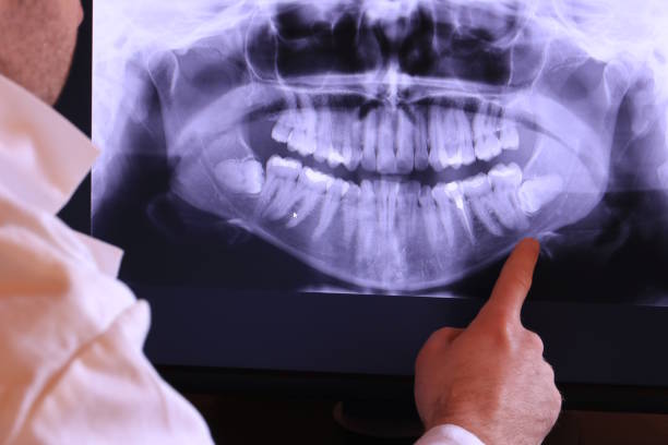 Best Emergency Root Canal Treatment in Port Ludlow, WA